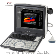 Color Portable Ultrasound Doppler